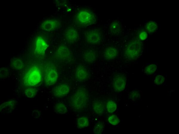 A2EN Human Endocervical Epithelial Cell Line | SCC131